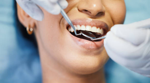 Best Emergency Tooth Extraction in Silver Ridge, NJ