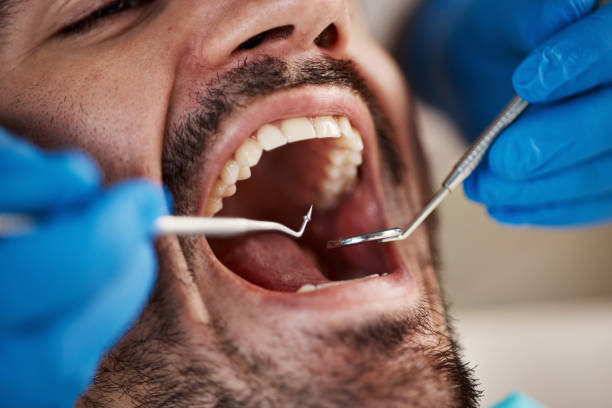 Best Urgent Care for Lost Fillings or Crowns in Silver Ridge, NJ