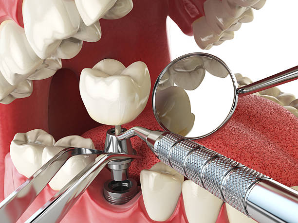 Best Same-Day Emergency Dental Services in Silver Ridge, NJ