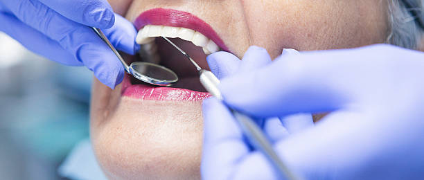 Best Emergency Treatment for Dental Infections or Abscesses in Silver Ridge, NJ